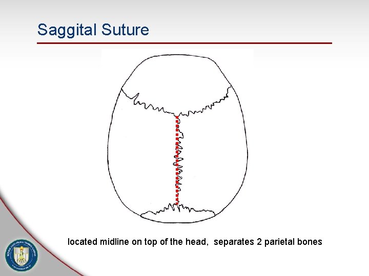 Saggital Suture located midline on top of the head, separates 2 parietal bones 