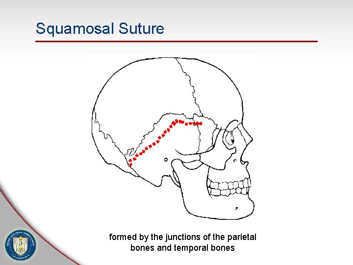 Squamosal Suture formed by the junctions of the parietal bones and temporal bones 