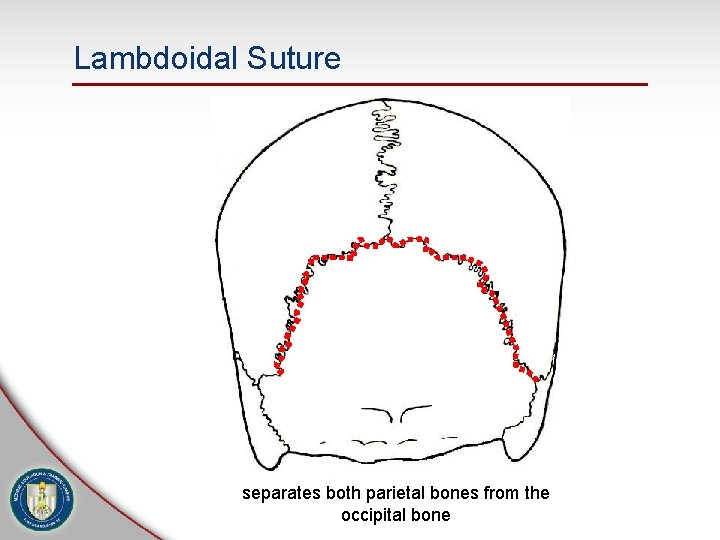 Lambdoidal Suture separates both parietal bones from the occipital bone 