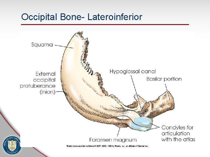 Occipital Bone- Lateroinferior • Basilar Portion 