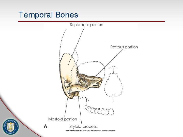 Temporal Bones 