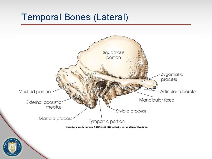 Temporal Bones (Lateral) 