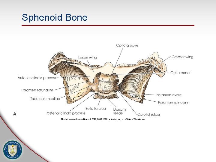 Sphenoid Bone 