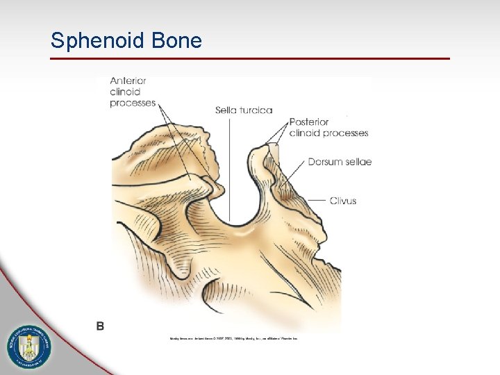 Sphenoid Bone 