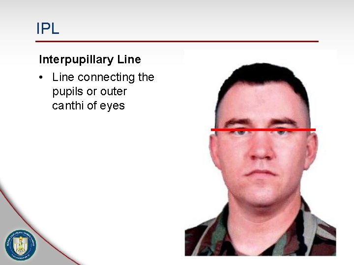 IPL Interpupillary Line • Line connecting the pupils or outer canthi of eyes 