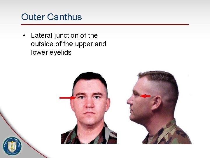 Outer Canthus • Lateral junction of the outside of the upper and lower eyelids