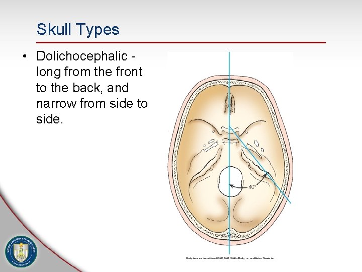 Skull Types • Dolichocephalic long from the front to the back, and narrow from