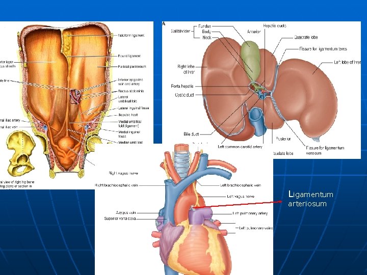 Ligamentum arteriosum 