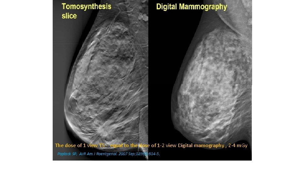 The dose of 1 view TS - equal to the dose of 1 -2