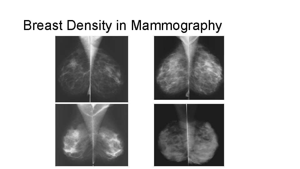 Breast Density in Mammography 