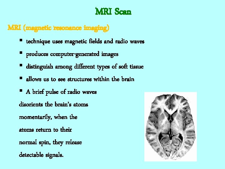 MRI Scan MRI (magnetic resonance imaging) § technique uses magnetic fields and radio waves