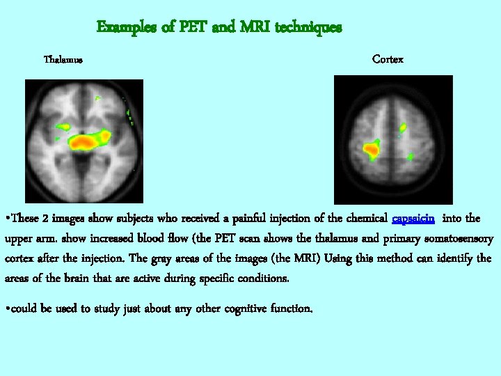 Examples of PET and MRI techniques Thalamus Cortex • These 2 images show subjects