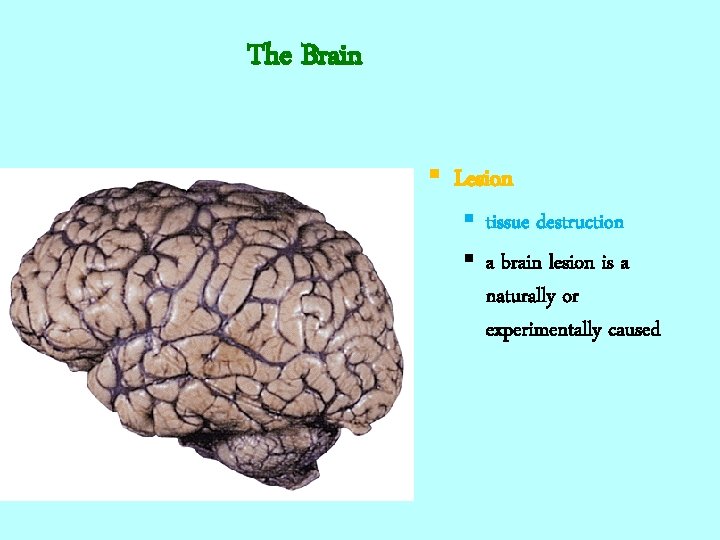 The Brain § Lesion § tissue destruction § a brain lesion is a naturally