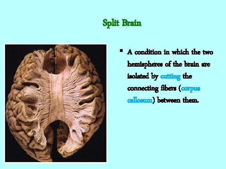 Split Brain § A condition in which the two hemispheres of the brain are