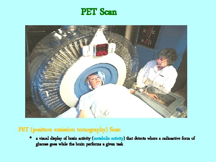 PET Scan PET (positron emission tomography) Scan § a visual display of brain activity
