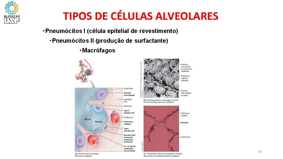 TIPOS DE CÉLULAS ALVEOLARES • Pneumócitos I (célula epitelial de revestimento) • Pneumócitos II