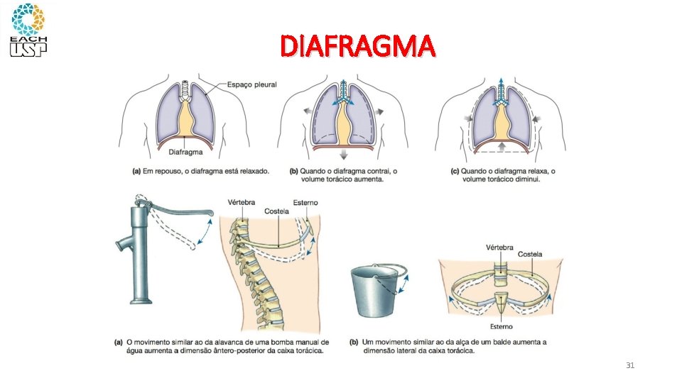 DIAFRAGMA 31 