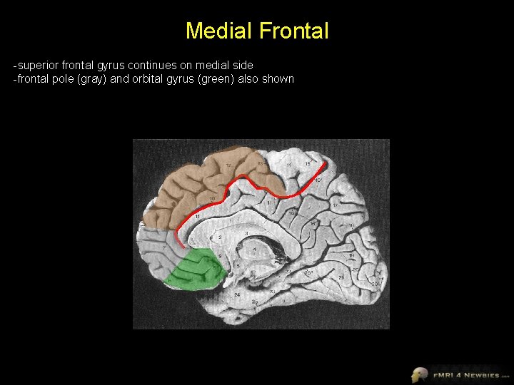 Medial Frontal -superior frontal gyrus continues on medial side -frontal pole (gray) and orbital