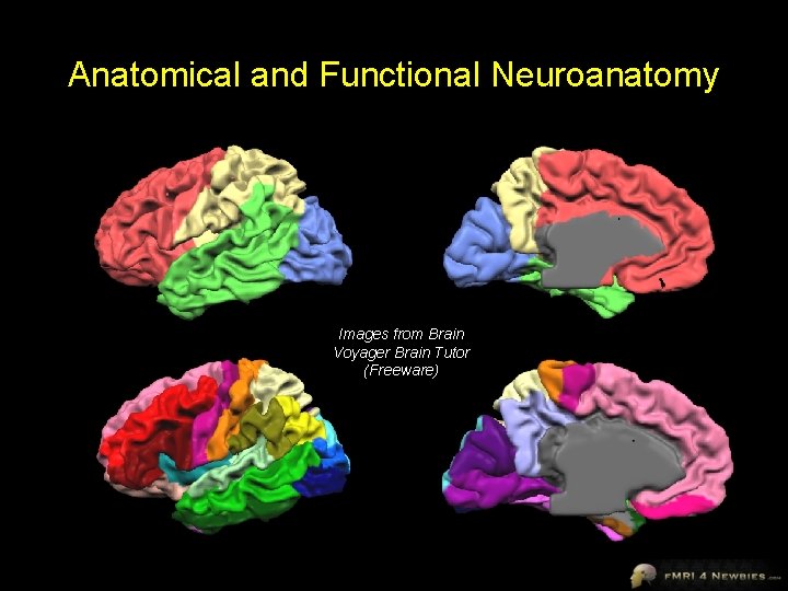 Anatomical and Functional Neuroanatomy Images from Brain Voyager Brain Tutor (Freeware) 