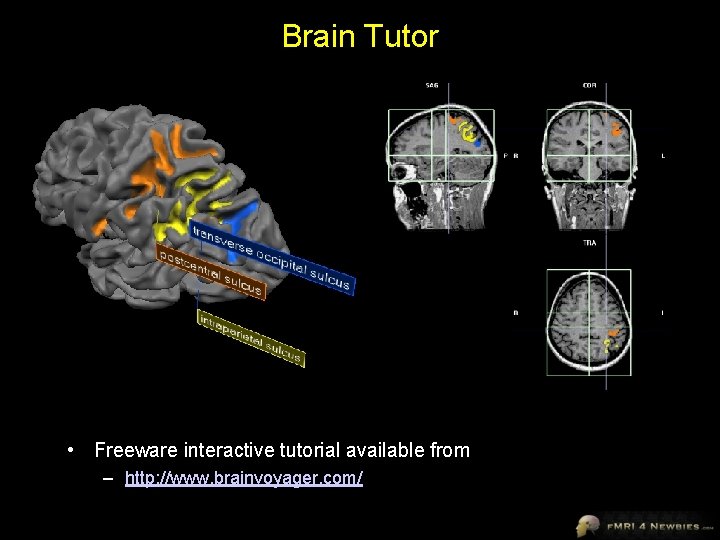 Brain Tutor • Freeware interactive tutorial available from – http: //www. brainvoyager. com/ 
