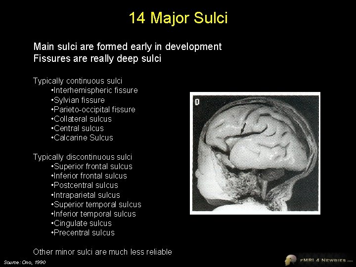 14 Major Sulci Main sulci are formed early in development Fissures are really deep