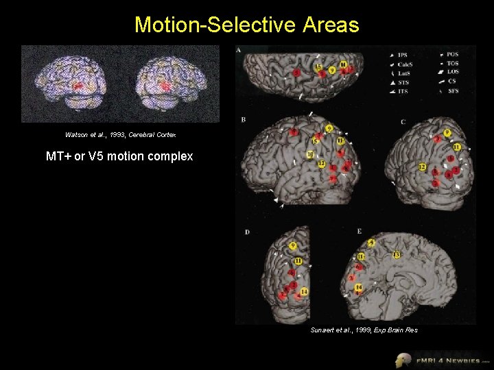 Motion-Selective Areas Watson et al. , 1993, Cerebral Cortex MT+ or V 5 motion