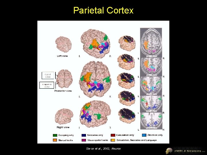 Parietal Cortex Simon et al. , 2002, Neuron 