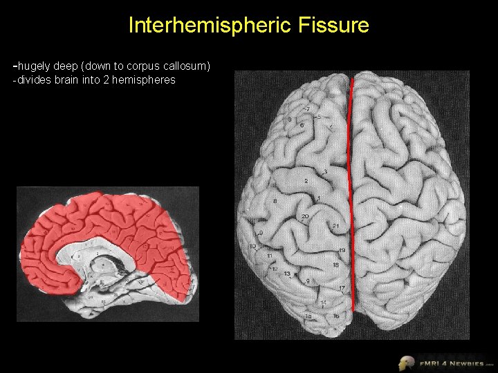 Interhemispheric Fissure -hugely deep (down to corpus callosum) -divides brain into 2 hemispheres 