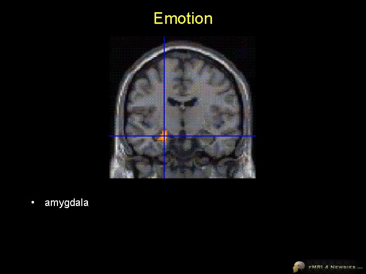 Emotion • amygdala 