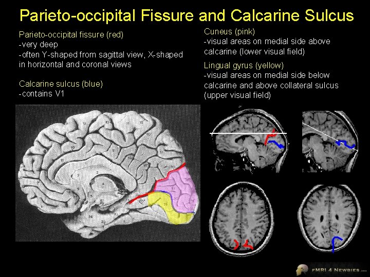 Parieto-occipital Fissure and Calcarine Sulcus Parieto-occipital fissure (red) -very deep -often Y-shaped from sagittal