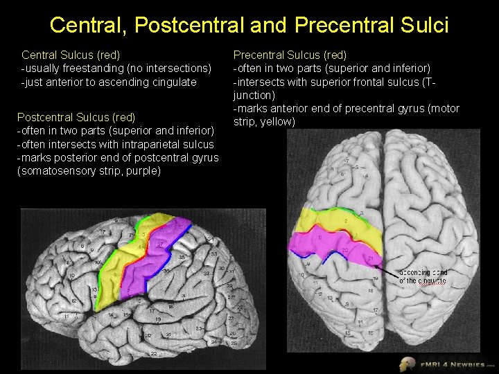 Central, Postcentral and Precentral Sulci Central Sulcus (red) -usually freestanding (no intersections) -just anterior