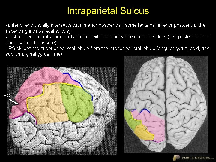 Intraparietal Sulcus -anterior end usually intersects with inferior postcentral (some texts call inferior postcentral