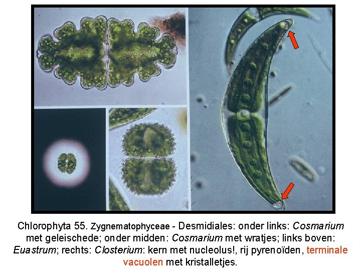 Chlorophyta 55. Zygnematophyceae - Desmidiales: onder links: Cosmarium met geleischede; onder midden: Cosmarium met