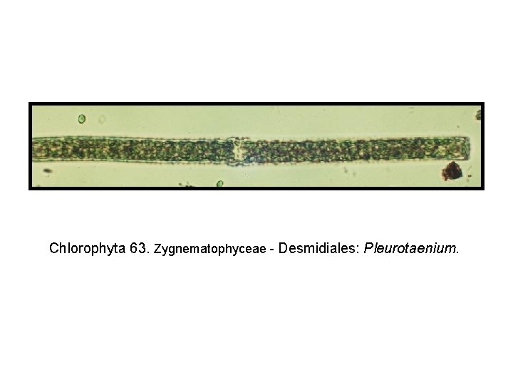 Chlorophyta 63. Zygnematophyceae - Desmidiales: Pleurotaenium. 