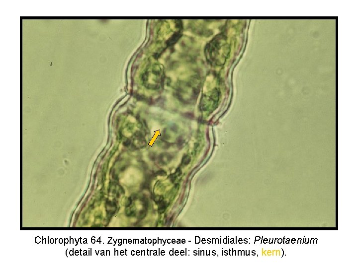 Chlorophyta 64. Zygnematophyceae - Desmidiales: Pleurotaenium (detail van het centrale deel: sinus, isthmus, kern).