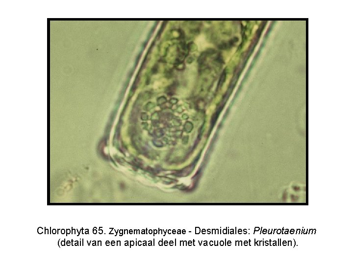 Chlorophyta 65. Zygnematophyceae - Desmidiales: Pleurotaenium (detail van een apicaal deel met vacuole met