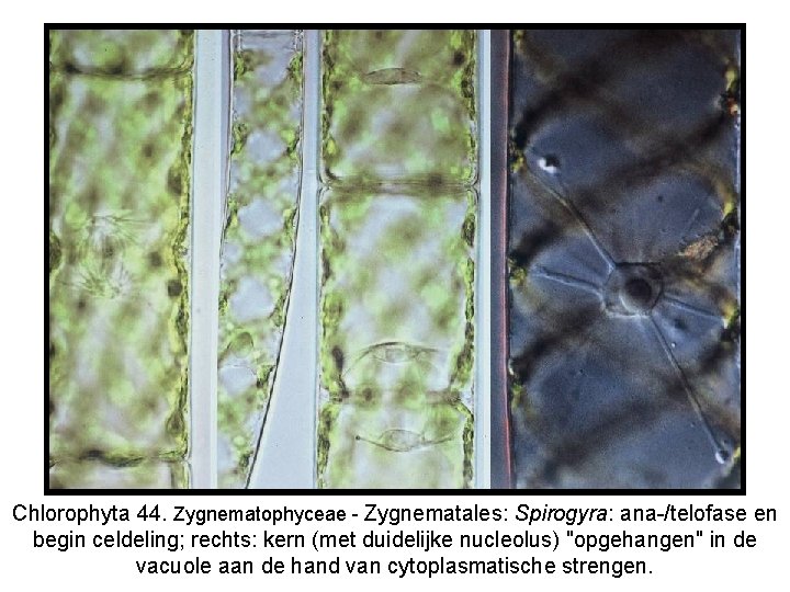 Chlorophyta 44. Zygnematophyceae - Zygnematales: Spirogyra: ana-/telofase en begin celdeling; rechts: kern (met duidelijke