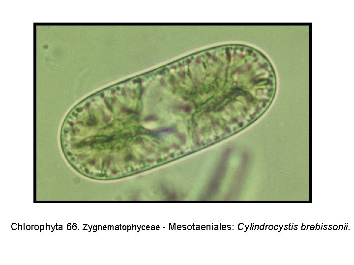 Chlorophyta 66. Zygnematophyceae - Mesotaeniales: Cylindrocystis brebissonii. 