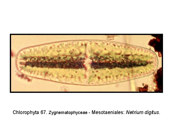 Chlorophyta 67. Zygnematophyceae - Mesotaeniales: Netrium digitus. 