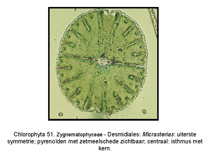 Chlorophyta 51. Zygnematophyceae - Desmidiales: Micrasterias: uiterste symmetrie; pyrenoïden met zetmeelschede zichtbaar; centraal: isthmus