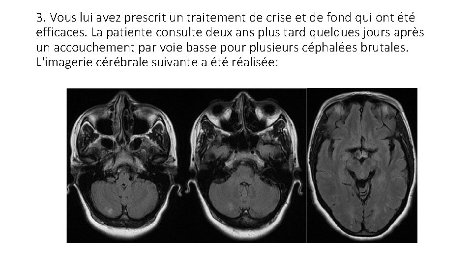 3. Vous lui avez prescrit un traitement de crise et de fond qui ont