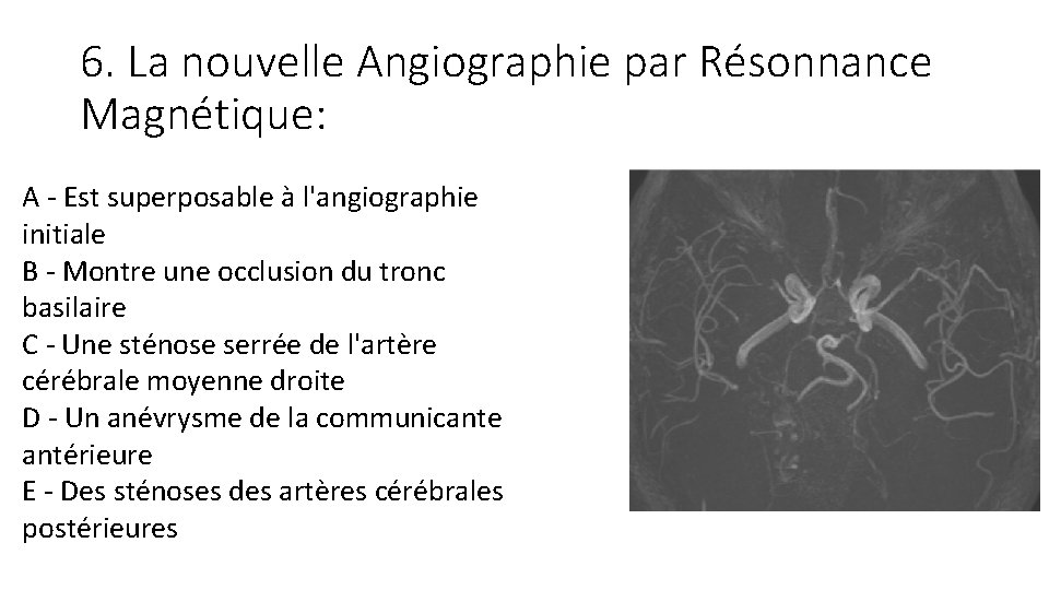 6. La nouvelle Angiographie par Résonnance Magnétique: A - Est superposable à l'angiographie initiale