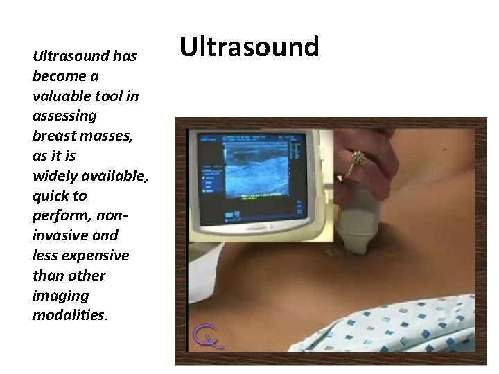 Ultrasound has become a valuable tool in assessing breast masses, as it is widely