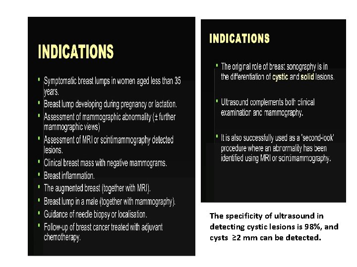 The specificity of ultrasound in detecting cystic lesions is 98%, and cysts ≥ 2