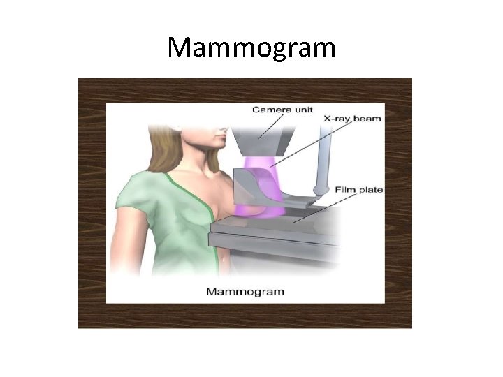 Mammogram 