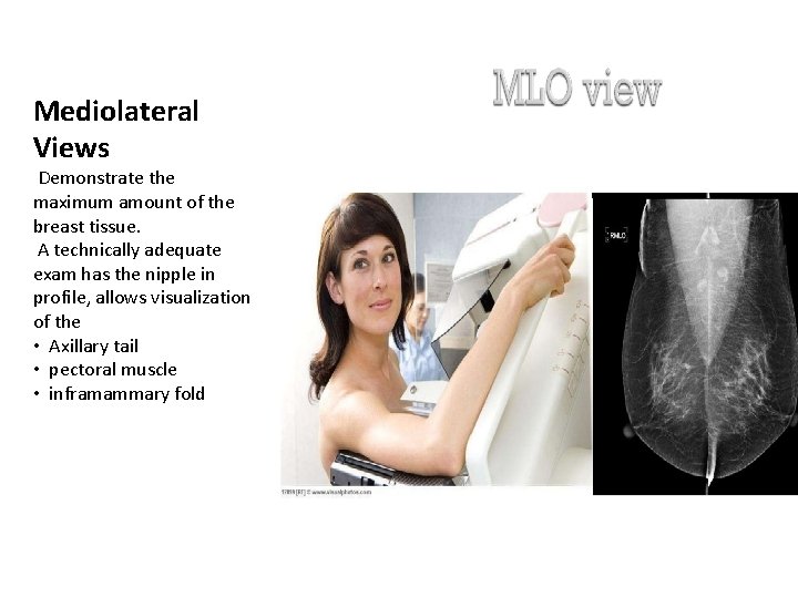 Mediolateral Views Demonstrate the maximum amount of the breast tissue. A technically adequate exam