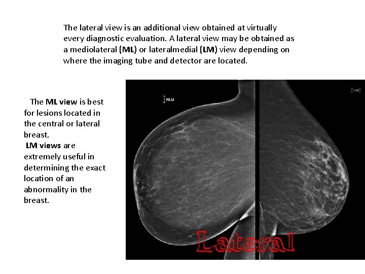 The lateral view is an additional view obtained at virtually every diagnostic evaluation. A