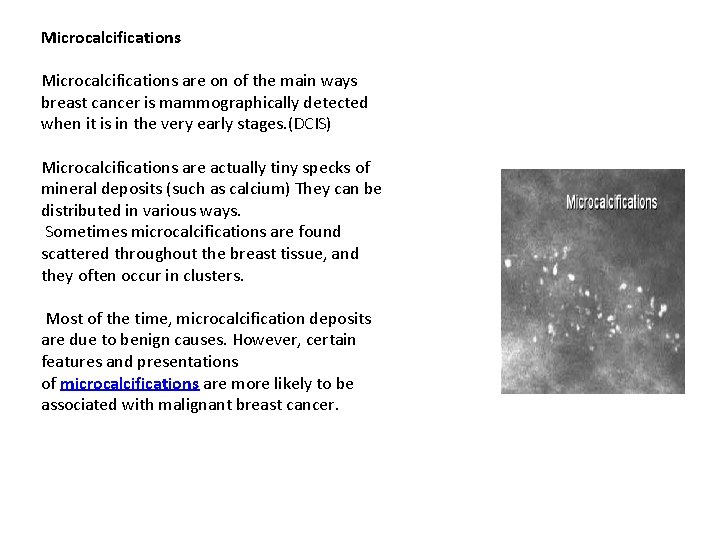 Microcalcifications are on of the main ways breast cancer is mammographically detected when it