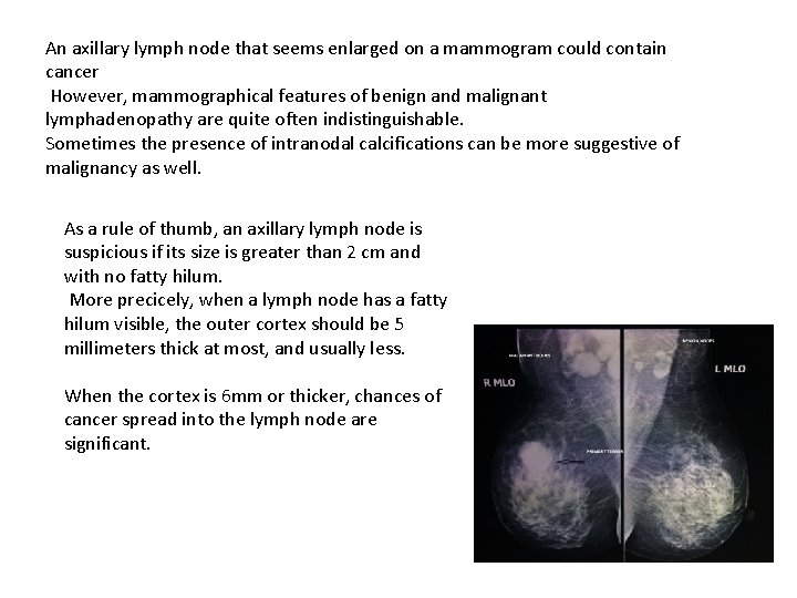 An axillary lymph node that seems enlarged on a mammogram could contain cancer However,