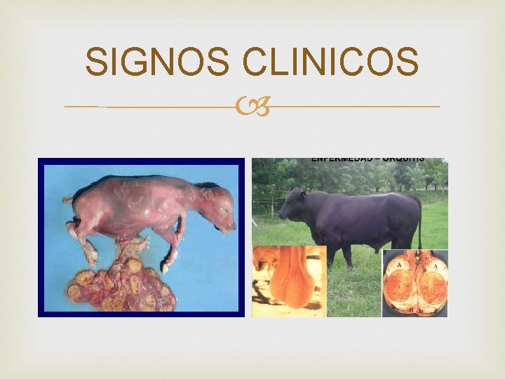 SIGNOS CLINICOS 